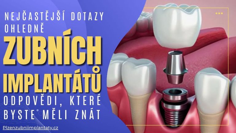 Nejčastější dotazy ohledně zubních implantátů_ Odpovědi, které byste měli znát