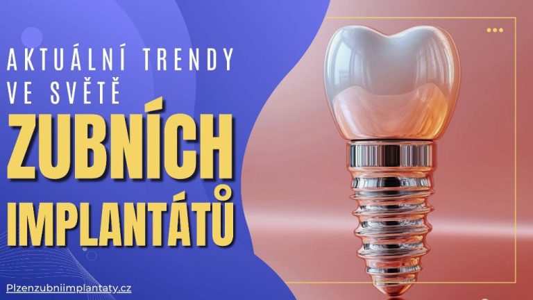 Aktuální trendy ve světě zubních implantátů
