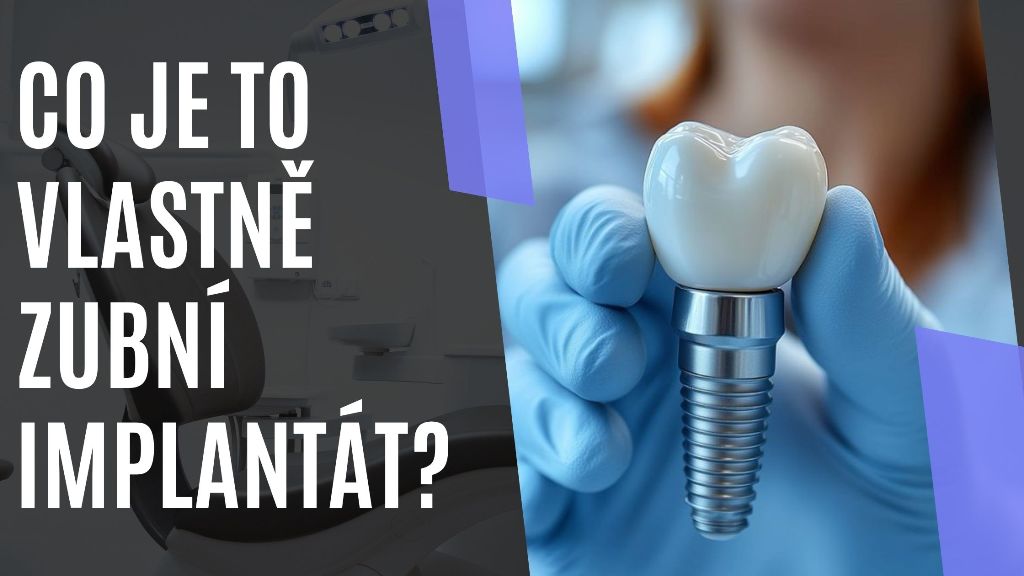 Co je to vlastně zubní implantát