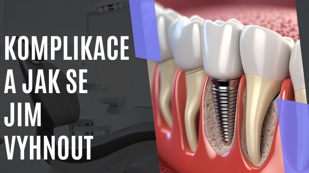 Komplikace a jak se jim vyhnout