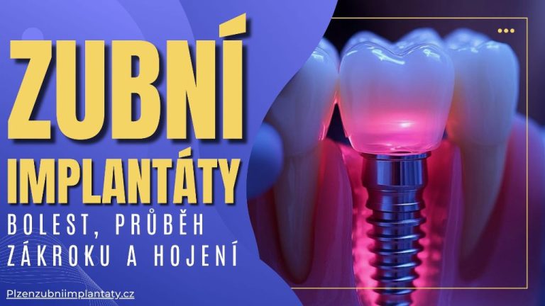 Zubní implantáty – bolest, průběh zákroku a hojení