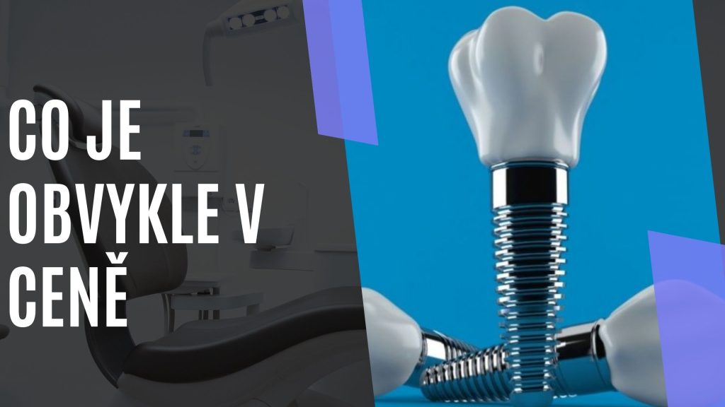 Co je obvykle v ceně