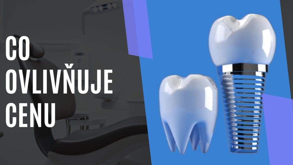 Co ovlivňuje cenu