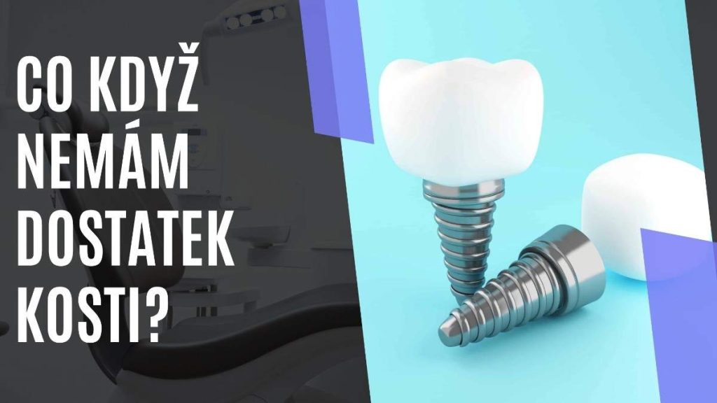 Cokdynemmdostatekkosti