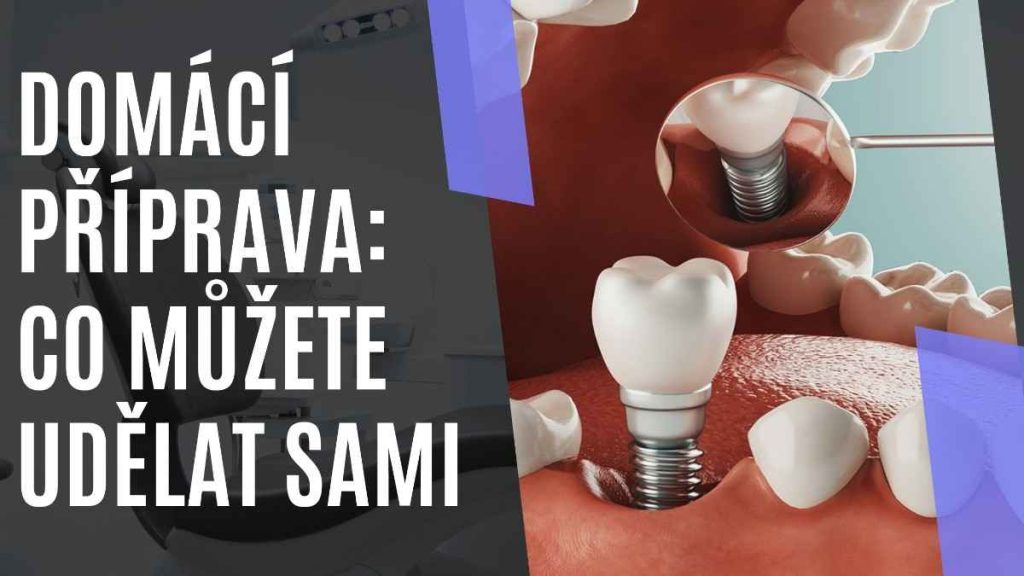 Domcpprava_cometeudlatsami