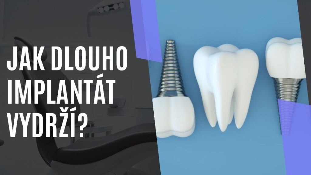Jakdlouhoimplanttvydr