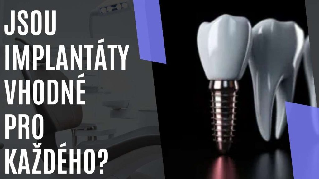 Jsouimplanttyvhodnprokadho