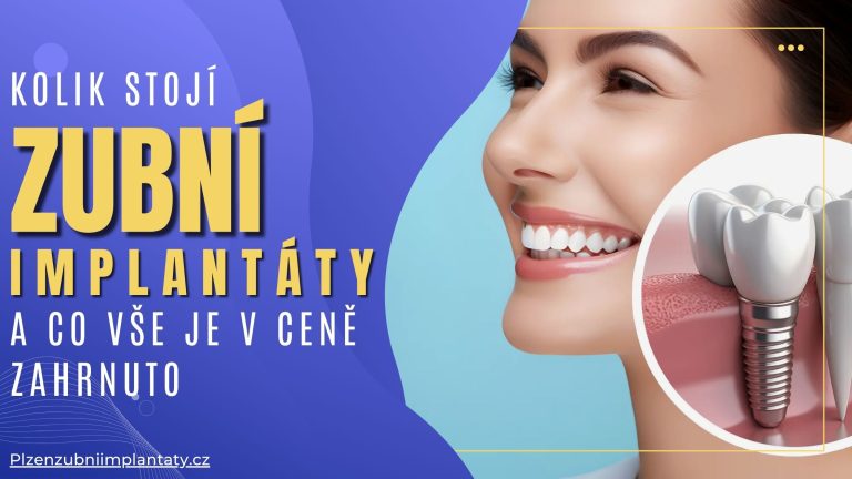 Kolik stojí zubní implantáty a co vše je v ceně zahrnuto