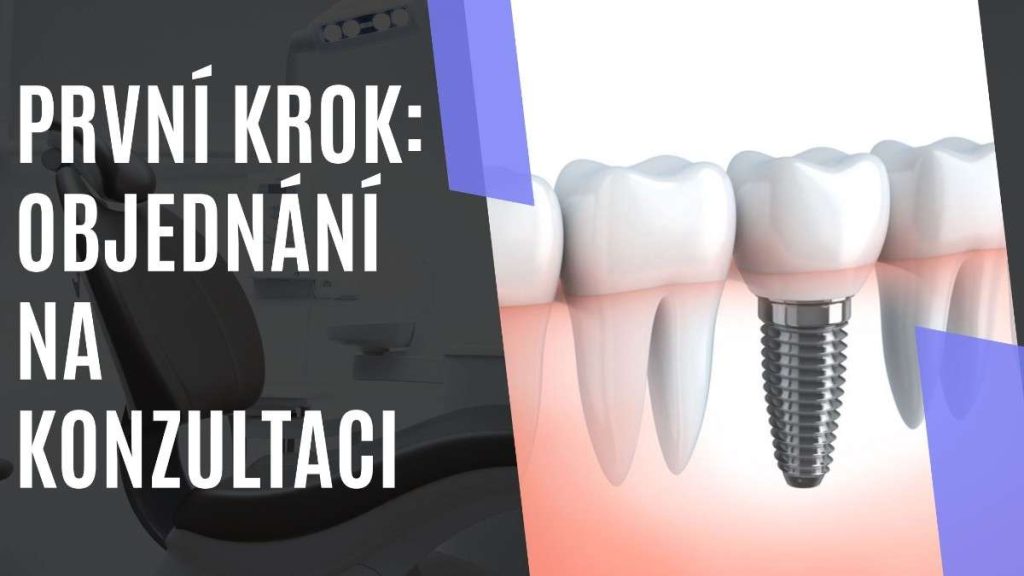 Prvnkrok_objednnnakonzultaci