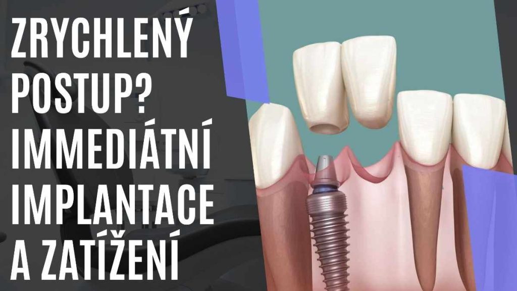 Zrychlenpostup_Immeditnimplantaceazaten