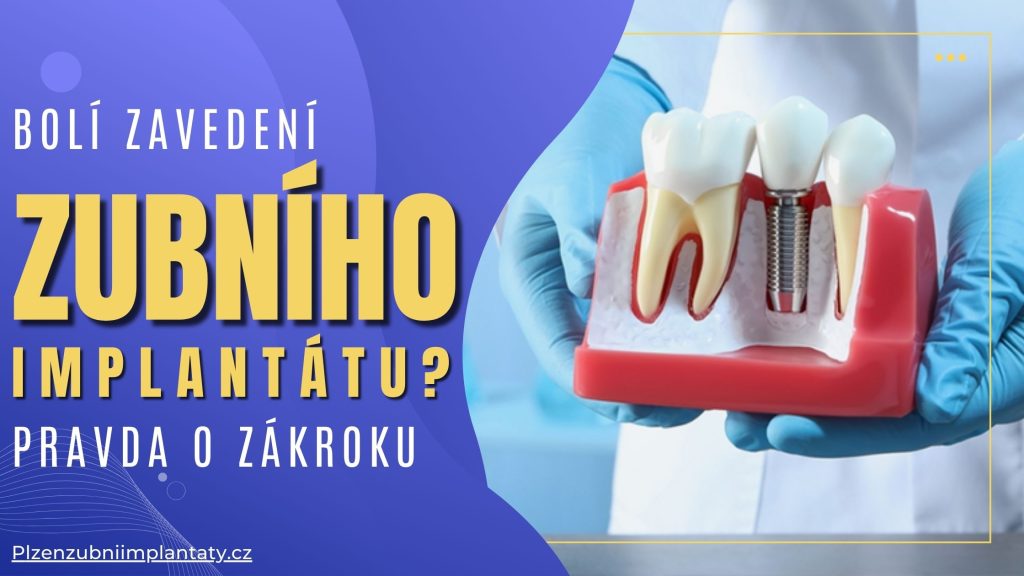 Bolí zavedení zubního implantátu Pravda o zákroku